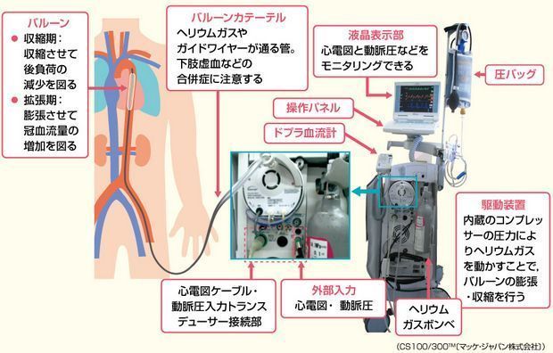 体験談 緊急車両通りま す 臨床工学技士になるんだ